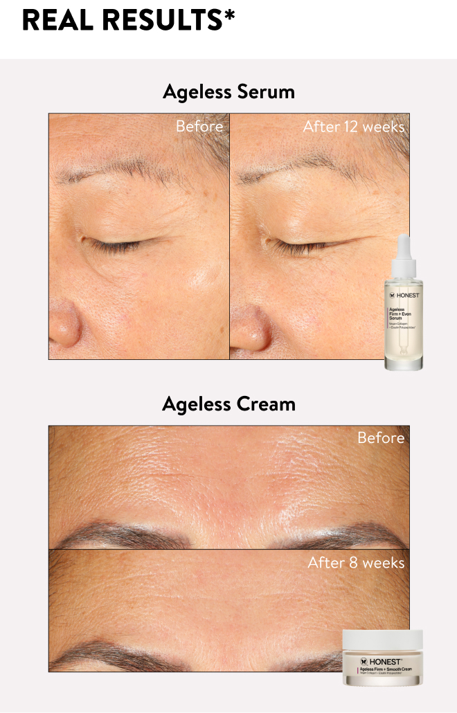 Real Results* before and after images of the Ageless Serum and Ageless Cream